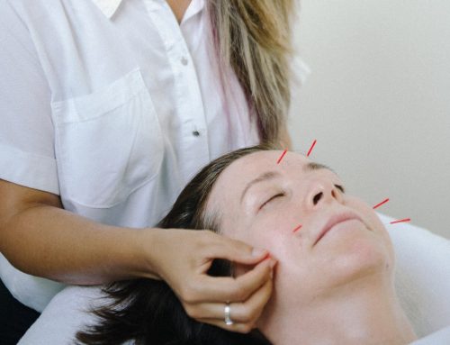 Facial Acupuncture in Vancouver: Unlocking the Secrets of Glowing Skin